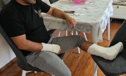 Saldırıya uğradı, ayağı iki yerden kırıldı!